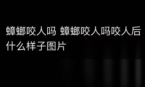 蟑螂咬人吗 蟑螂咬人吗咬人后什么样子图片