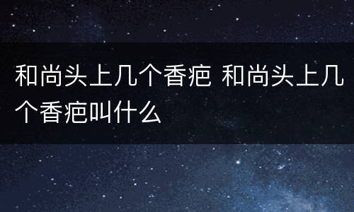 和尚头上几个香疤 和尚头上几个香疤叫什么